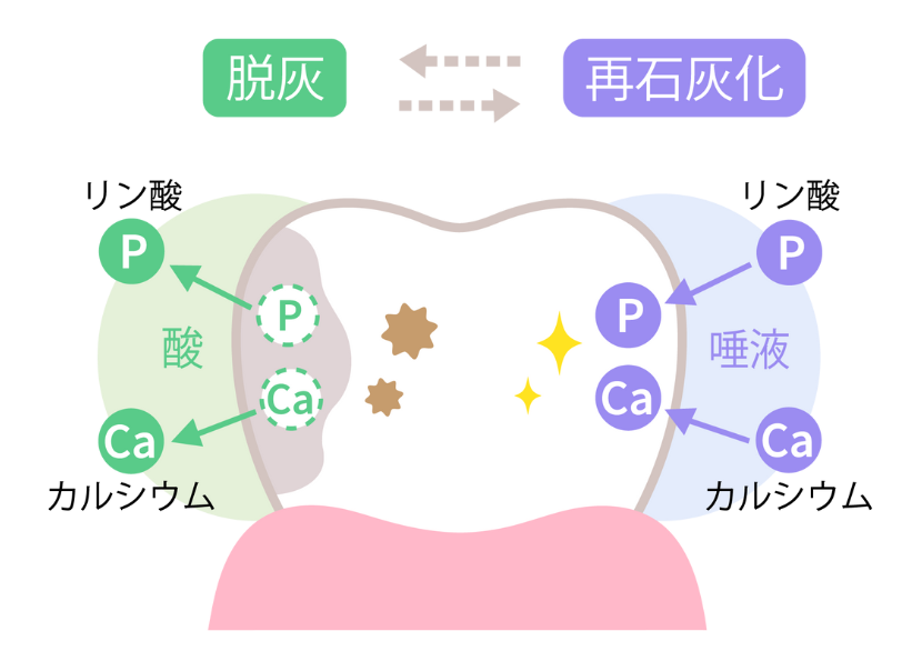 なぜ虫歯になるのか｜こばやし歯科