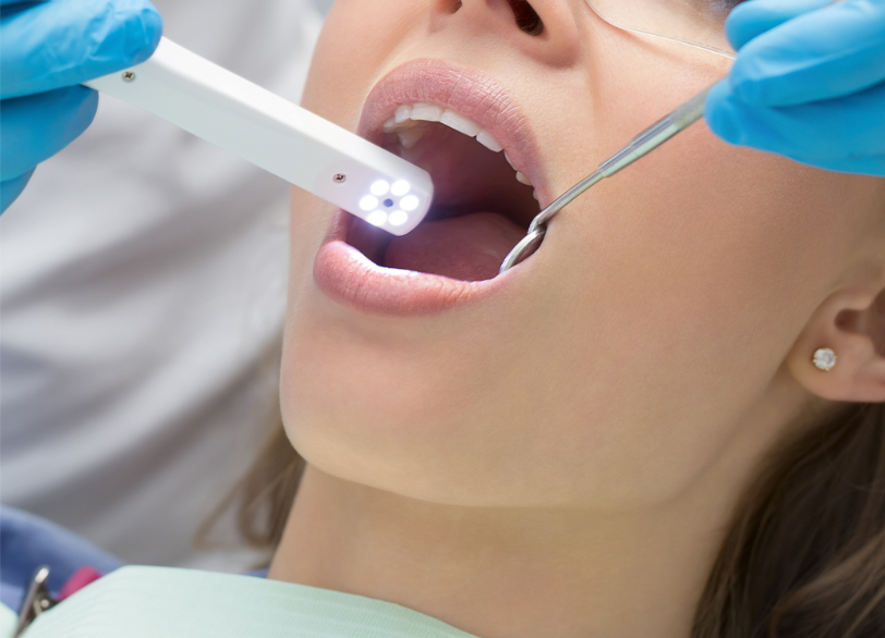 口腔内カメラ｜こばやし歯科