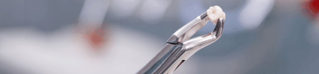 抜歯のタイミング｜こばやし歯科