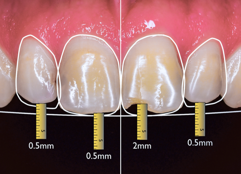 デジタルスマイルデザイン｜こばやし歯科