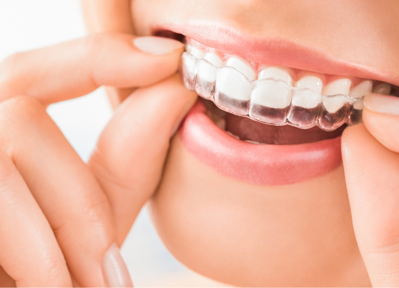 見た目への配慮|こばやし歯科