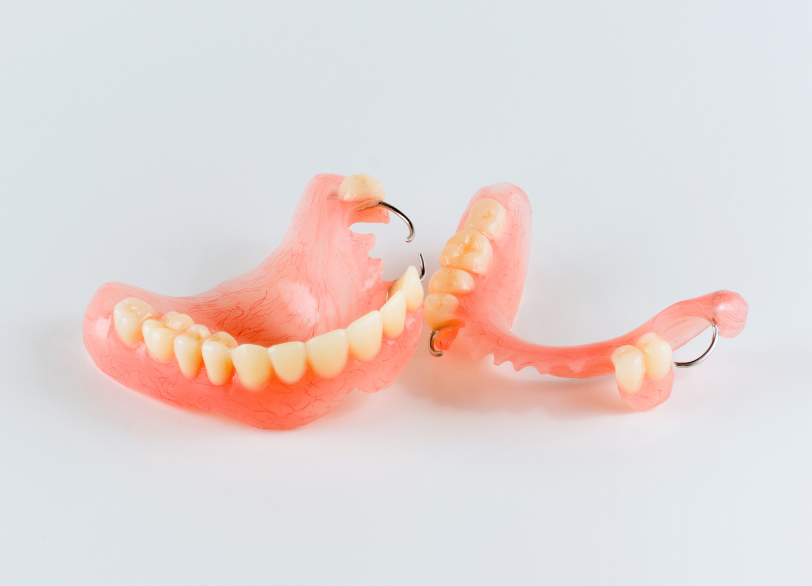 レジン床｜こばやし歯科