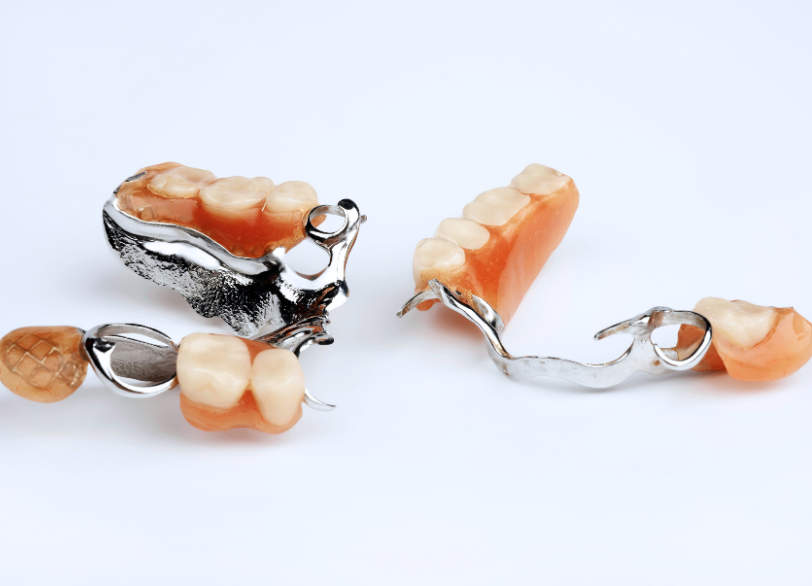 金属床義歯｜こばやし歯科