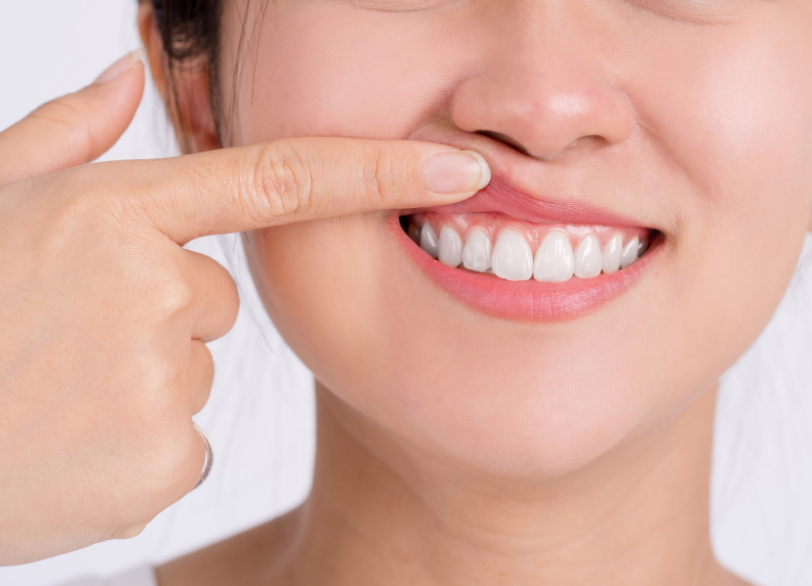 健康的な歯茎｜こばやし歯科