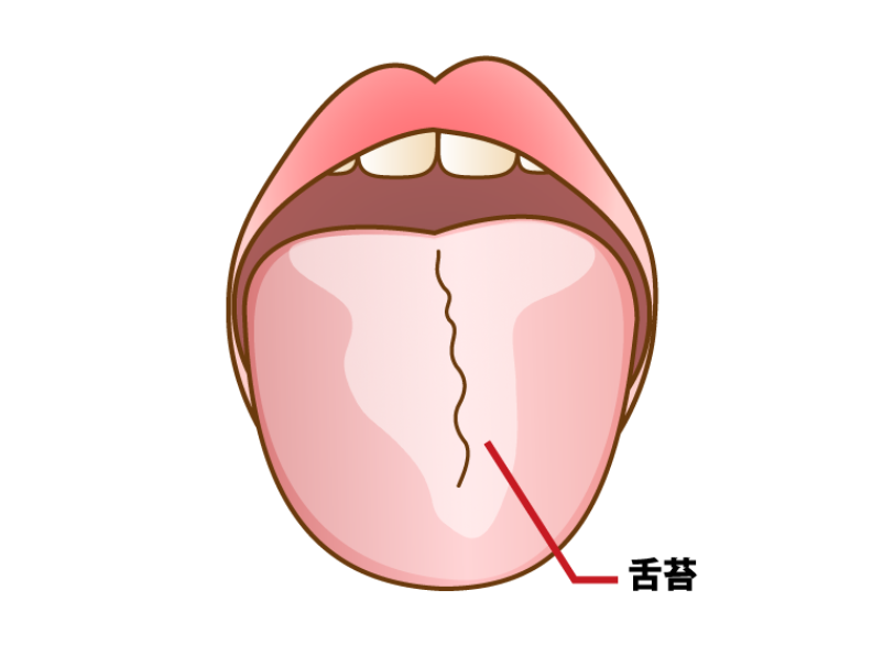 舌苔｜こばやし歯科