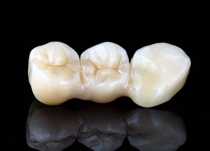 ブリッジ|こばやし歯科