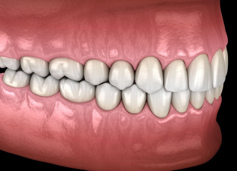 噛み合わせ｜こばやし歯科