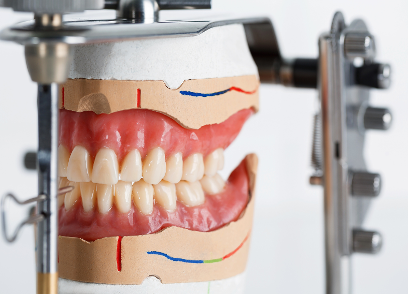 咬合分析器｜こばやし歯科