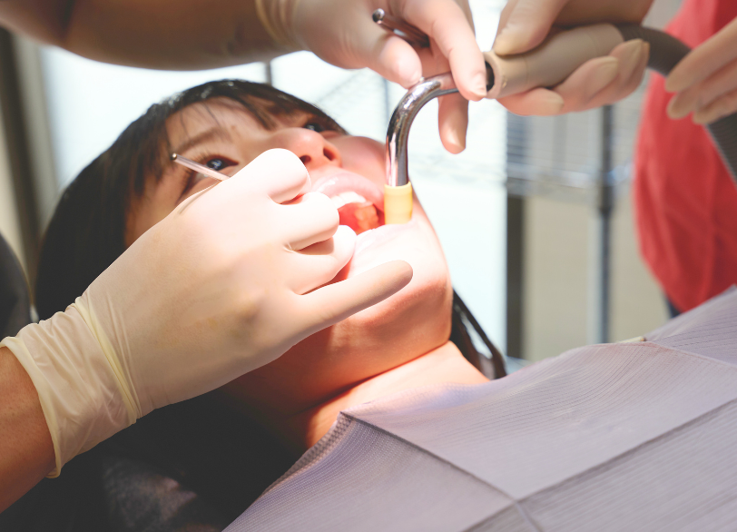 スケーリング｜こばやし歯科