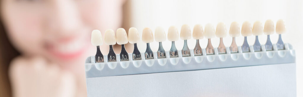 白い歯を長持ちさせるために｜こばやし歯科