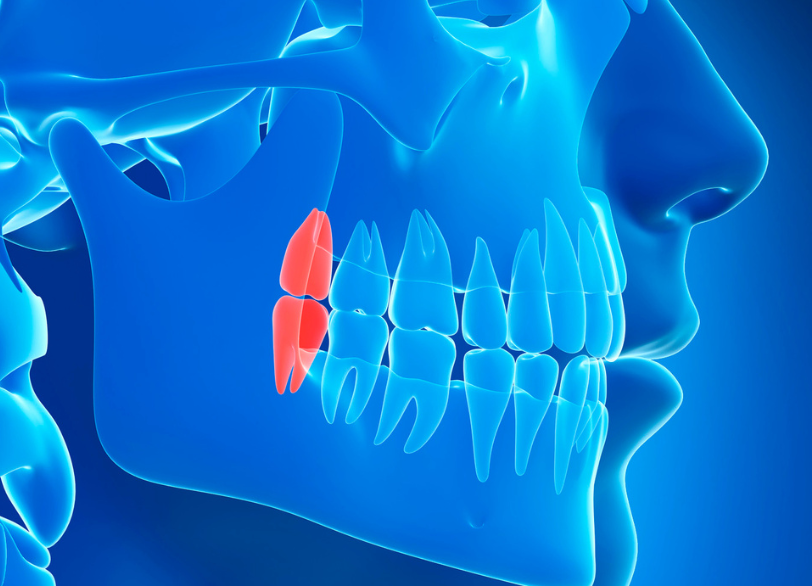 すべての親知らずを抜く必要はありません｜こばやし歯科