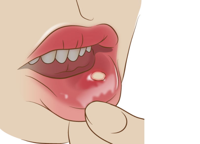 こんな症状に注意｜こばやし歯科